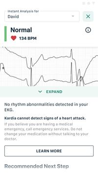 Kardia心电图检测免费版4